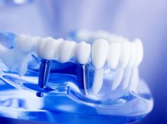 Возвращение к безупречному образу: Зубное протезирование для идеального внешнего вида