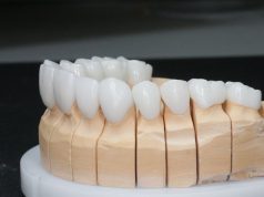 Коронки на зубы: из каких материалов бывают