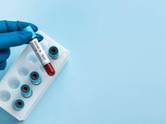 Периодичность лабораторных анализов: зачем и как часто нужно их сдавать