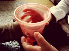 К чему снится кровь из сосков