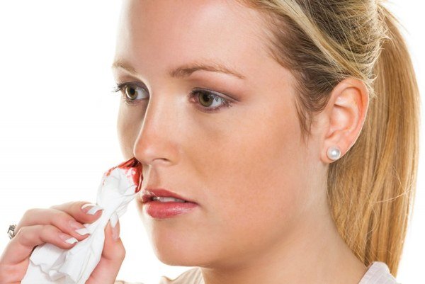 Кровь из носа: причины и способы остановить кровь